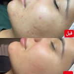 خدمات تخصصی پوست فیشال و کربوکسی فائزه