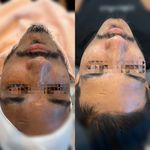 فیشال و پاکسازی تخصصی توسط پیراپزشک