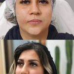 مرکز پوست و لیزر  سایناشور آمریکا دلدار