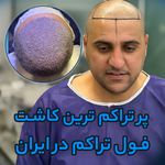 کلینیک پوست و کاشت مو ارغوان