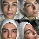 پاکسازی پوست و مو مهسام