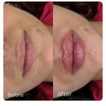 مرکز پوست، مو، زیبایی و لیزر هُلو