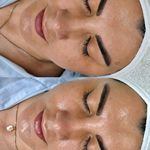 پاکسازی پوست و مو مهسام