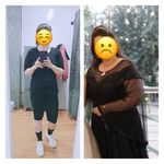 مرکز ایکس بادی پناهنده