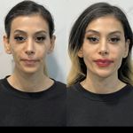 کلینیک زیبایی بلا