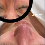 کلینیک فیشال و ماساژ سارن اسکین سارا