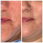 خدمات فیشال ،پاکسازی ندادمیرچی کلینیکBKD