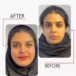 کلینیک زیبایی شایلی