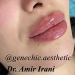 مطب پوست مو زیبایی و لاغری ژن شیک