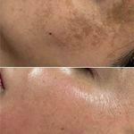 خدمات تخصصی فیشال و اسکالپ سر