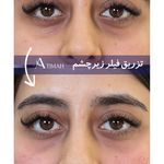 مجموعه زیبایی آتیماه