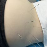 تزریقات درمنزل