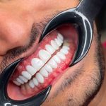 دندانسازی صدف(عسگری)