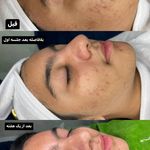 آموزش وخدمات تخصصی پوست خواهران جعفرزاده