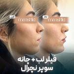 کلینیک زیبایی مانشید