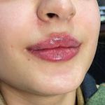 کلینیک تخصصی لیزر موهای زائد پریناز شرق