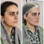 کلینیک زیبایی و لیزر مایا (دکتر وحیدی)