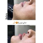 مرکز پوست، مو، زیبایی و لیزر هُلو