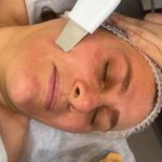 مرکز پاکسازی پوست کیمیا اسکین