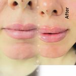 کلینیک زیبایی -لاغری
