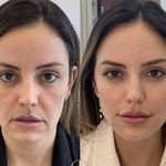 کلینیک پوست مو و لیزر ماهلار ۲۰درصدتخفیف