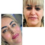 کلینیک لیزر و زیبایی دایان