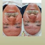 خدمات تخصصی پوست و مو مریم نصیرپور