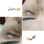 مژگان اسکین کرMojgan skincare