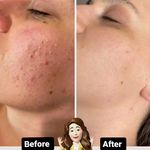 Skincare _eliamini