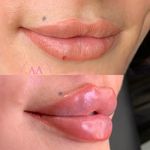 کلینیک زیبایی آزیتا آذر