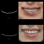 فتوگرافی پزشکی مظلومی