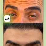 کلینیک پوست مو زیبایی و لیزر کهربا