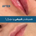 کلینیک زیبایی و جوانسازی پوست و مو الین