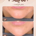 مرکز زیبایی مایلا