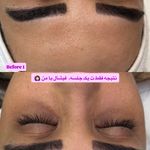 خدمات تخصصی پاکسازی پوست فروغ یزدانی