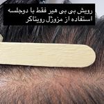 مرکز لیزر موهای زائد ماهور