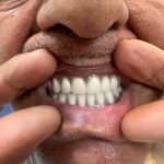 دندانسازی داود یارمحمدی