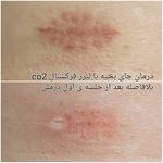 کلینیک زیبایی پوست و مو آتریسا