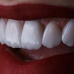 دندانپزشکی دکتر آزاده خلجیان