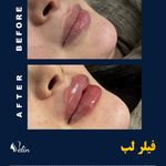 کلینیک زیبایی و جوانسازی پوست و مو الین