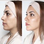 کلینیک زیبایی و لاغری بلو بیوتی|پاسداران