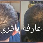 مرکز تخصصی اسکالپ تراپی (عارفه باقری)