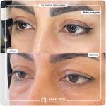 کلینیک پوست مو و زیبایی نوین ایرانا