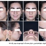 رادیولوژی و سونوگرافی بتا