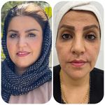 کلینیک زیبایی هانا