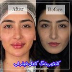 کلینیک پوست و مو بلانژ