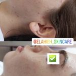 پاکسازی پوست الهه دوستی