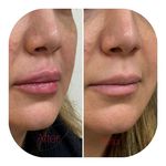 مطب زیبایی دکتر سیده زهرا حسینی