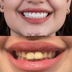 دندانپزشکی دیجیتال دکتر نازنین مهرآور