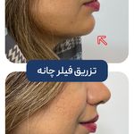 کلینیک زیبایی و جوانسازی پوست و مو الین